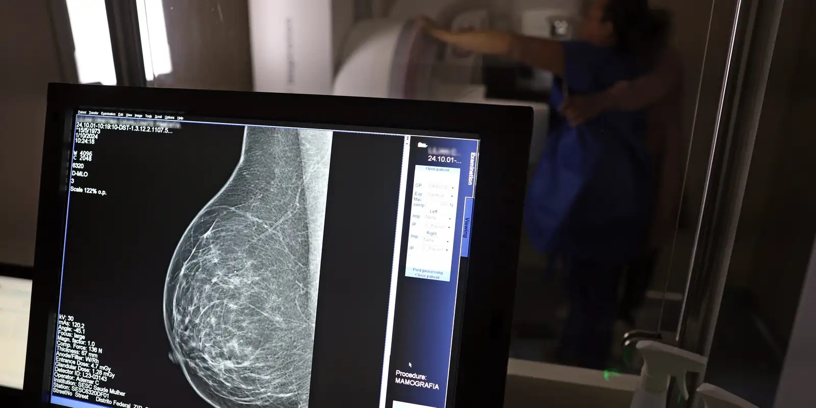 Planos de saúde devem cobrir mamografia digital sem restrição de idade